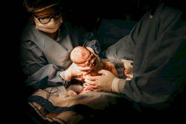 How Often Should You Be Getting A Pap Smear?